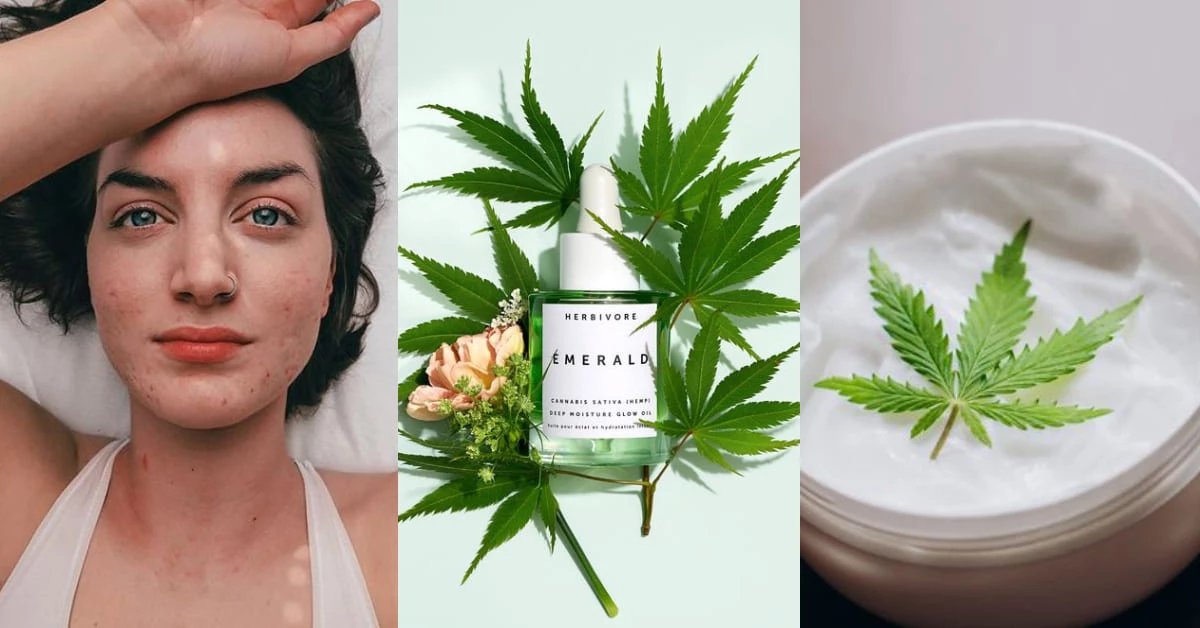 大麻也能當保養?網路超夯「大麻籽油」紅什麼?竟是美容專家讚不絕口的抗痘救星