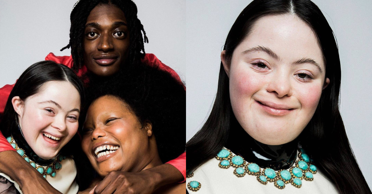 Gucci Beauty找來「非典型美女」扛封面!首位「唐氏症模特兒」綻放全世界最療癒笑容,超級名模閃邊站